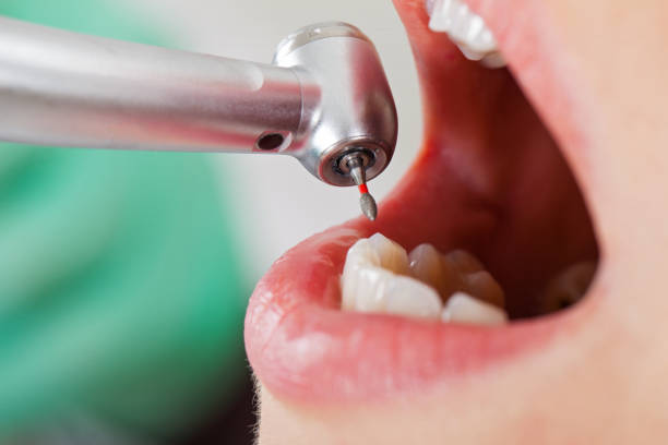 Best Emergency Dental Services for Seniors in West Leechburg, PA
